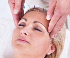 Barrhaven Chinese Acupuncture Clinic