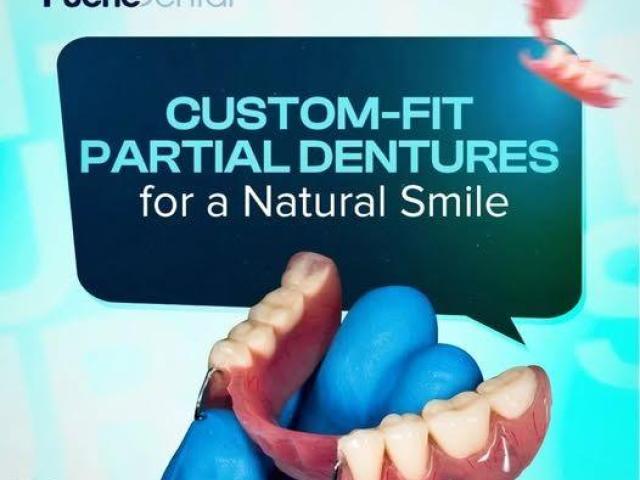 Puche dental implants