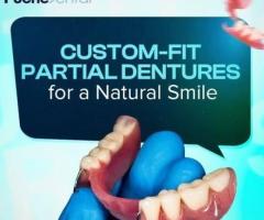 Puche dental implants