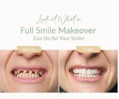 All-on-4 Implants Claremont