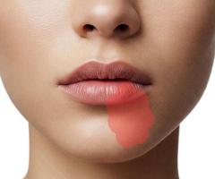 Complex tooth extractions Orange County