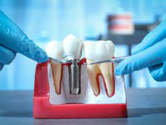 Best Oral & Maxillofacial Surgeon near Whittier