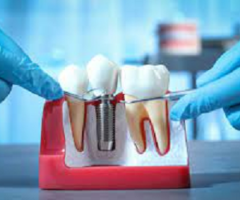 Best Oral & Maxillofacial Surgeon near Whittier