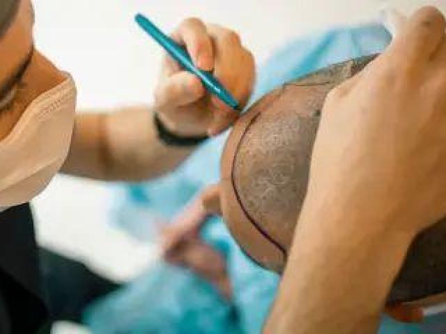 Bonitaa Skin & Hair Care Clinic in Gandhipuram, Coimbatore
