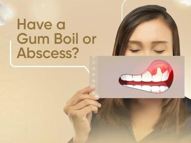 Dental Implant Restorations Claremont