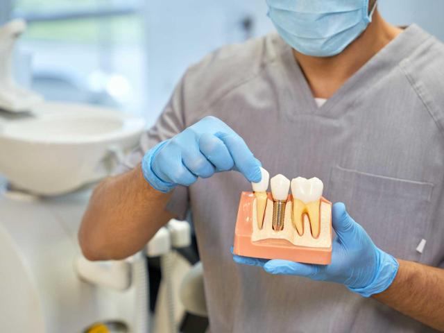 Get that Ideal Smile Makeover from the Best Tijuana Dentist
