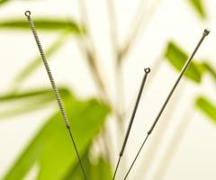 Cupping Therapy Millbrae, CA