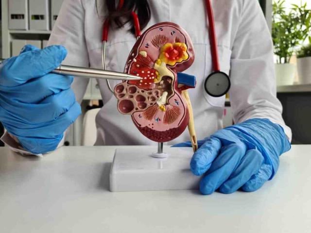 Expert Chronic Kidney Disease (CKD) Doctor for Comprehensive Kidney Care