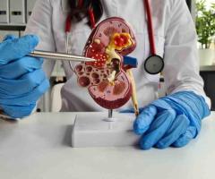 Expert Chronic Kidney Disease (CKD) Doctor for Comprehensive Kidney Care