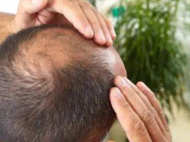 Best Skin & Hair Care Treatment Clinic in Coimbatore