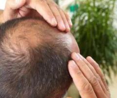 Best Skin & Hair Care Treatment Clinic in Coimbatore