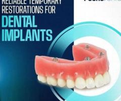 Elastic mandibular advancement
