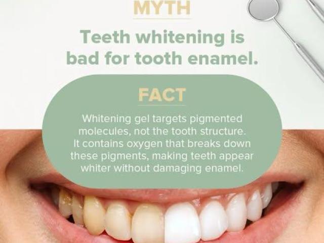 Dental Implant Restorations Claremont