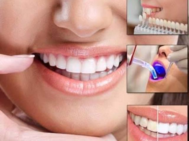 Best Implant Surgery in Whittier, California