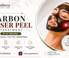 Best Carbon Laser Peel Treatment in Indore – Aestheva