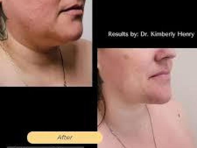 Plastic Surgery for Men Greenbrae