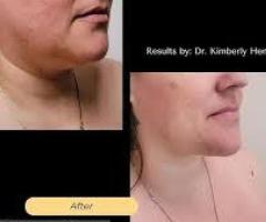 Plastic Surgery for Men Greenbrae