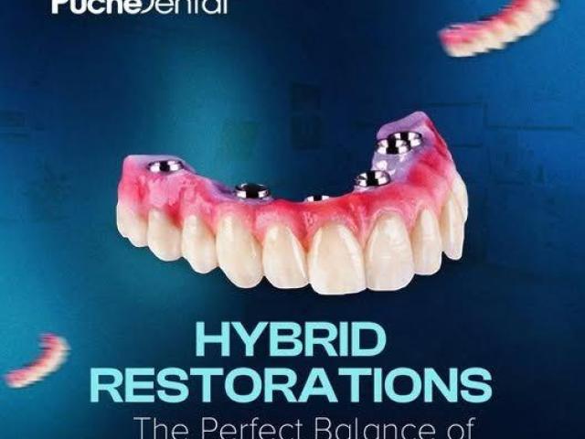 Hybrid Zirconia Denture