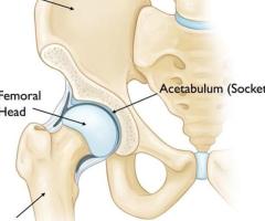 Best Joint Replacement Surgery Specialists in Kurnool| Dr. Y. HariPrasad Reddy