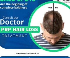 Laser treatment clinic in india