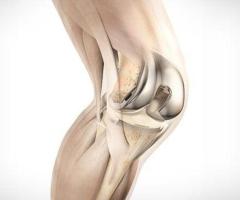Best Orthopedic Surgeons in Kurnool at Sri Sai Satya Hospital