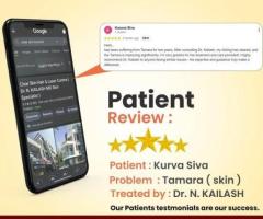 best Vitiligo Treatments in india