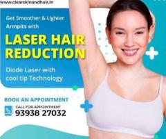 PRP hair Treatment in india